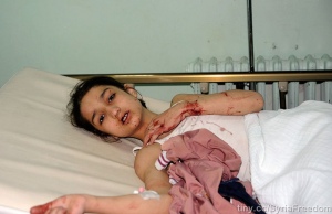. Une fillette blessée par une bombe à Damas le 26.10.2012. Galerie de FreeDomhouse. (CC BY 2.0) 